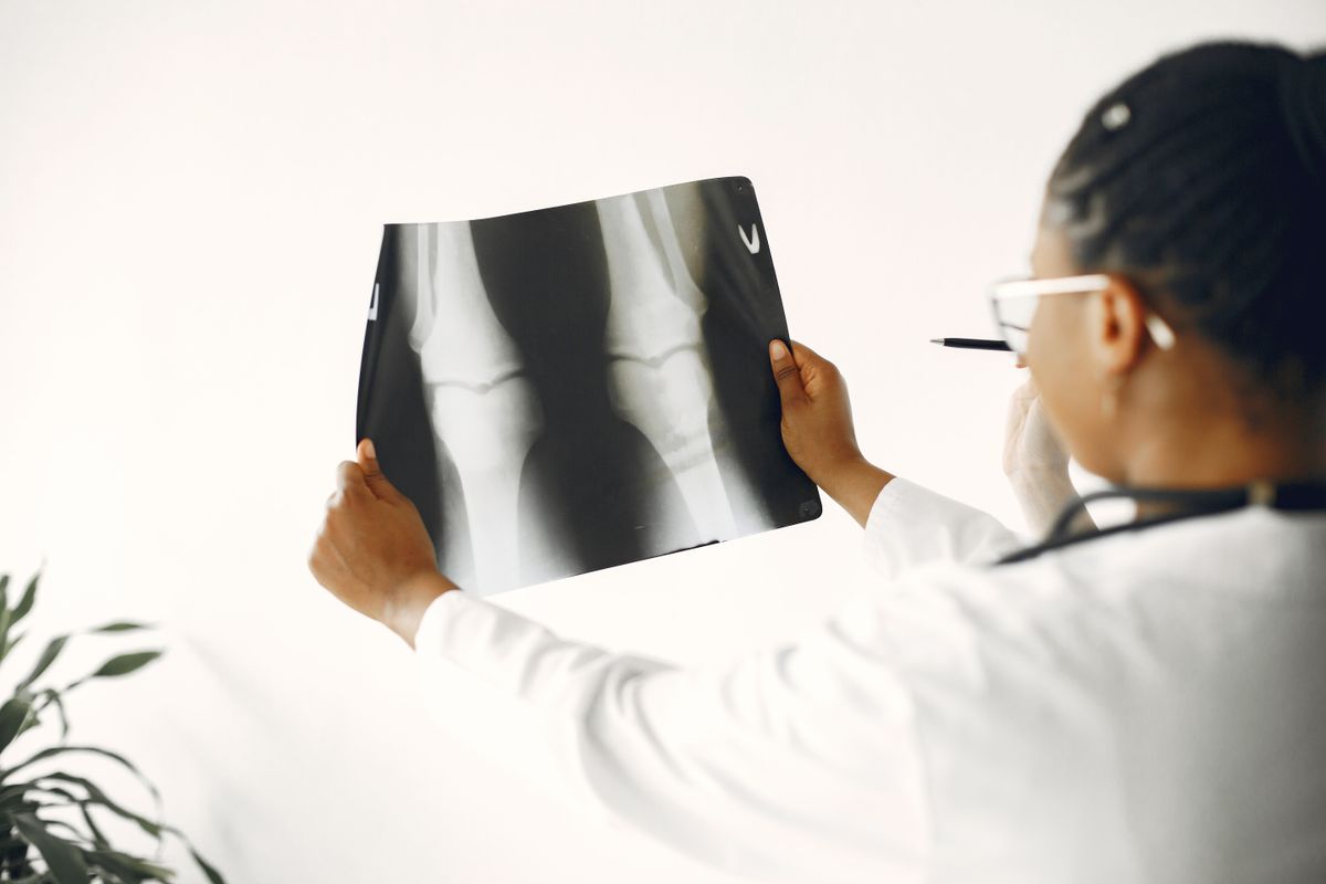 Clinician reviewing X-rays of both knees.