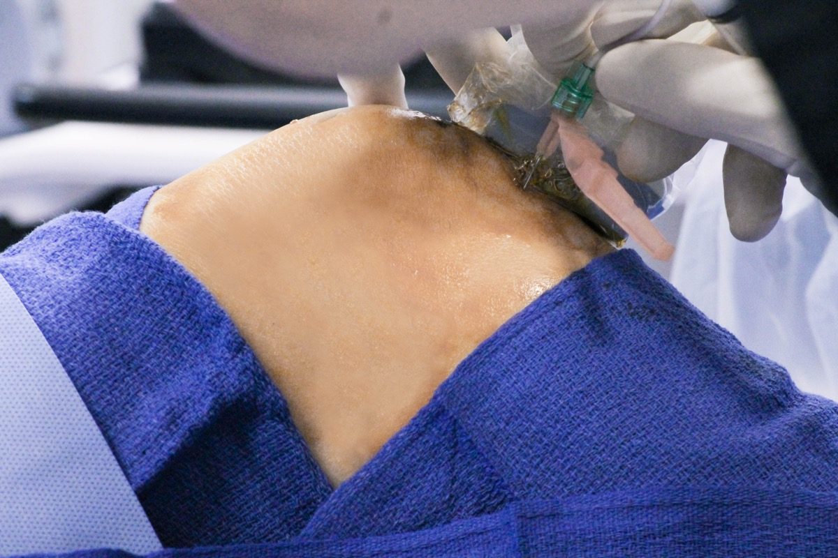 Knee pain treatment options beyond surgery