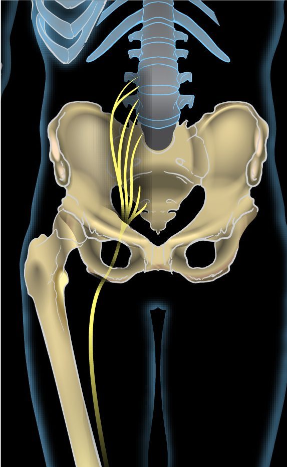 Sciatica nerve pain radiating down the leg
