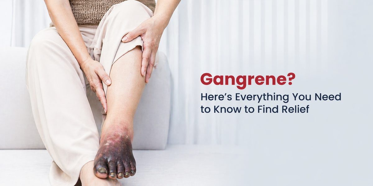 Illustration of vascular disease and poor blood supply affecting the lower limbs