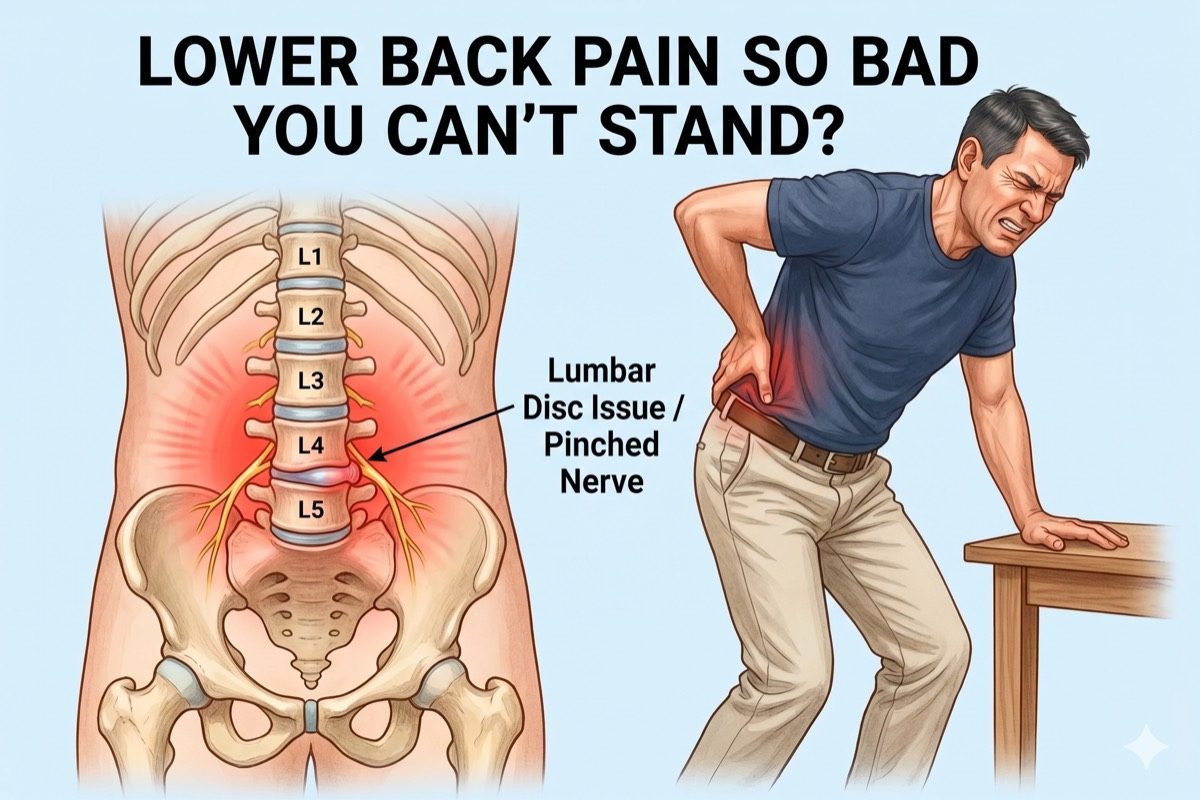 Illustration of lumbar disc herniation and facet joint arthritis