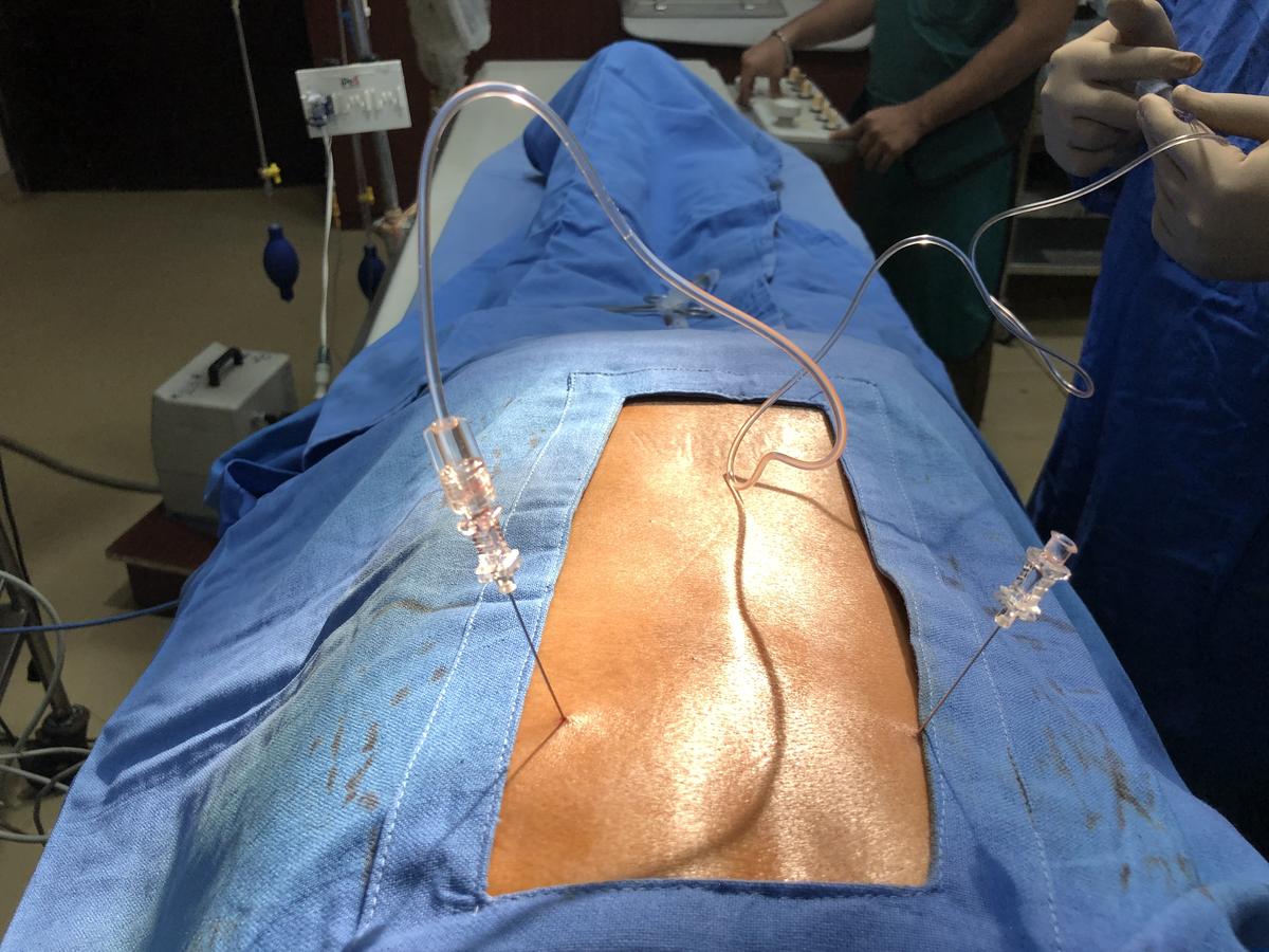 Doctor performing an image-guided cancer pain procedure